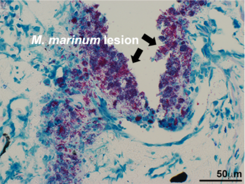 M. marinum lesion